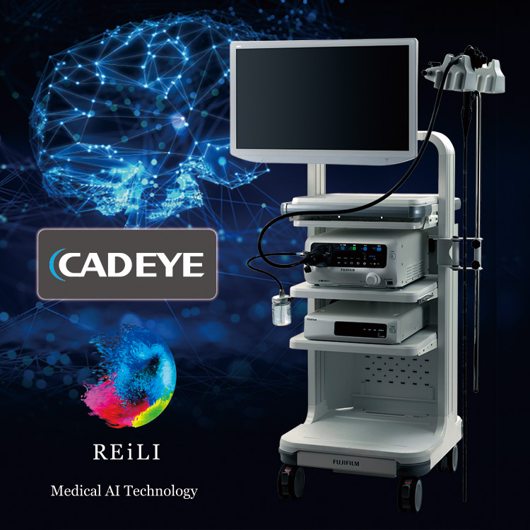 AIによる内視鏡画像診断支援システムを導入